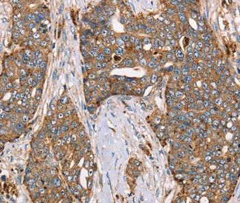 Immunohistochemistry (Formalin/PFA-fixed paraffin-embedded sections) - Anti-FUCA1 antibody - C-terminal (AB197984)