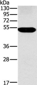Western blot - Anti-FUCA1 antibody - C-terminal (AB197984)