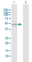 Western blot - Anti-FUCA2 antibody (AB169480)