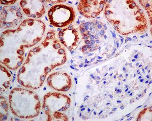 Immunohistochemistry (Formalin/PFA-fixed paraffin-embedded sections) - Anti-Fukutin antibody [EPR7913] (AB131280), expandable thumbnail