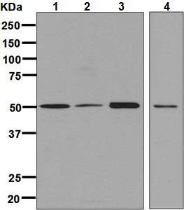 Western blot - Anti-Fukutin antibody [EPR7913] (AB131280), expandable thumbnail