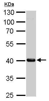 Western blot - Anti-Fumarylacetoacetate hydrolase/FAA antibody (AB151998)