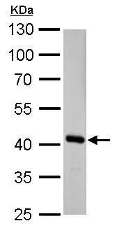 Western blot - Anti-Fumarylacetoacetate hydrolase/FAA antibody (AB151998)