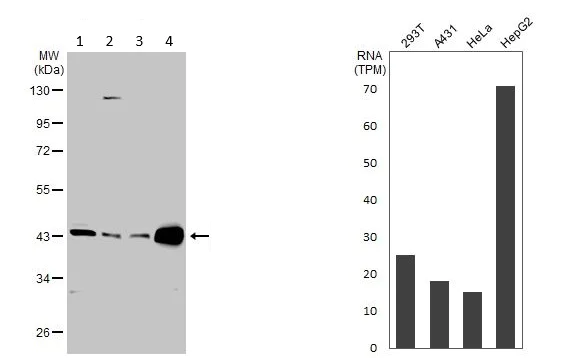 Western blot - Anti-Fumarylacetoacetate hydrolase/FAA antibody (AB151998)