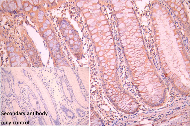 Immunohistochemistry (Formalin/PFA-fixed paraffin-embedded sections) - Anti-FUNDC1 antibody (AB224722)