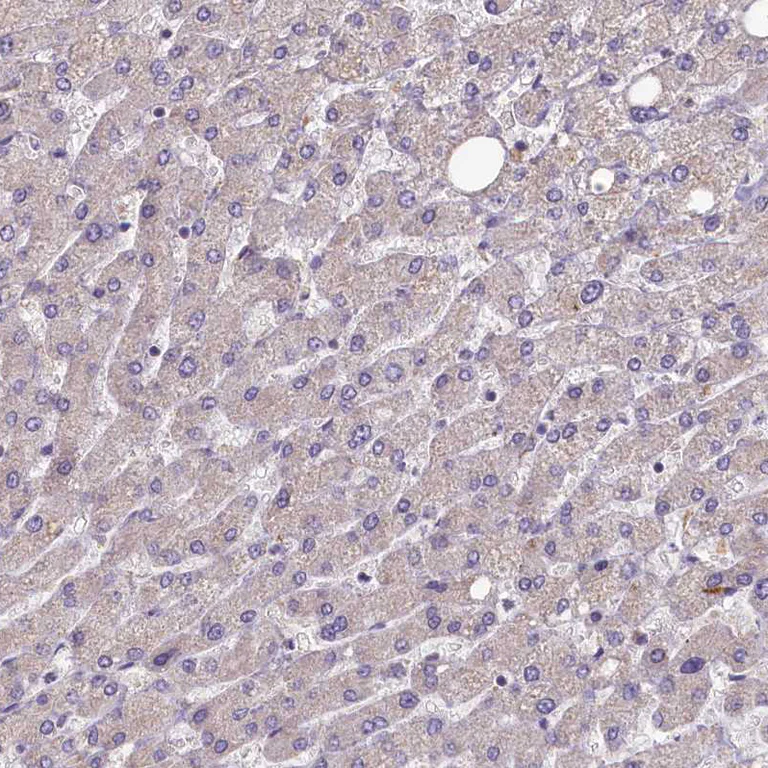 Immunohistochemistry (Formalin/PFA-fixed paraffin-embedded sections) - Anti-FUNDC1 antibody (AB272627)