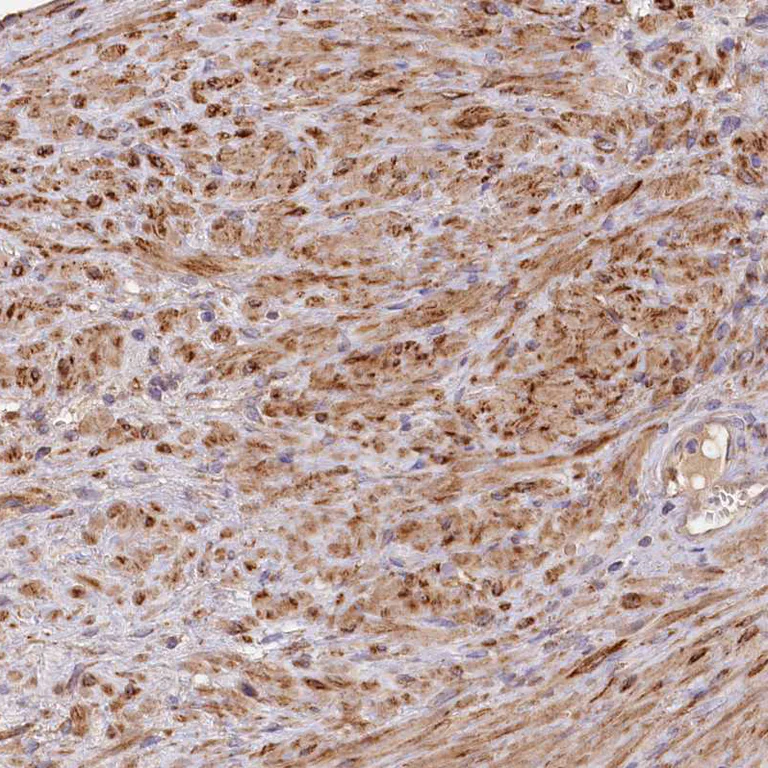 Immunohistochemistry (Formalin/PFA-fixed paraffin-embedded sections) - Anti-FUNDC1 antibody (AB272627)