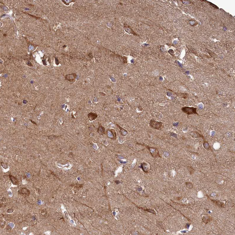 Immunohistochemistry (Formalin/PFA-fixed paraffin-embedded sections) - Anti-FUNDC1 antibody (AB272627)
