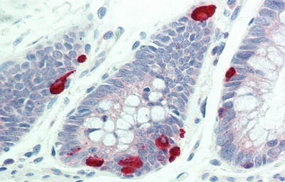 Immunohistochemistry (Formalin/PFA-fixed paraffin-embedded sections) - Anti-Furin antibody (AB231573)
