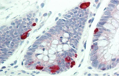 Immunohistochemistry (Formalin/PFA-fixed paraffin-embedded sections) - Anti-Furin antibody (AB231573)