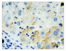 Immunohistochemistry (Formalin/PFA-fixed paraffin-embedded sections) - Anti-Furin antibody (AB231573)