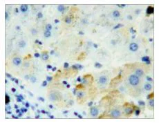 Immunohistochemistry (Formalin/PFA-fixed paraffin-embedded sections) - Anti-Furin antibody (AB231573)