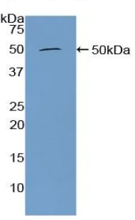 Western blot - Anti-Furin antibody (AB231573)