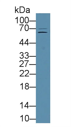 Western blot - Anti-Furin antibody (AB231573)