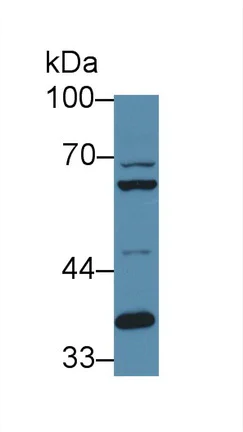 Western blot - Anti-Furin antibody (AB231573)