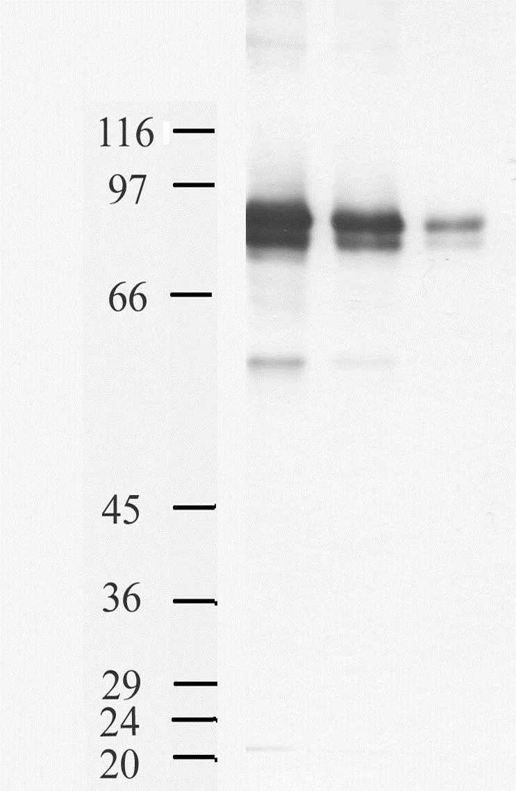 Western blot - Anti-Furin antibody (AB28547)