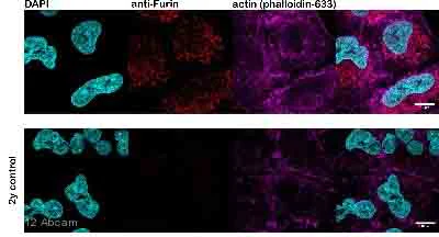 Immunocytochemistry - Anti-Furin antibody (AB3467)