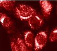 Immunocytochemistry - Anti-Furin antibody (AB3467)
