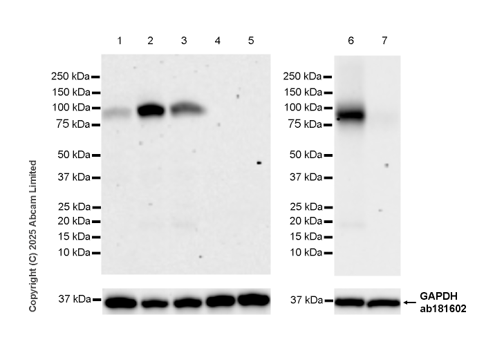 Western blot - Anti-FURIN antibody [EPR28939-503] (AB324231), expandable thumbnail