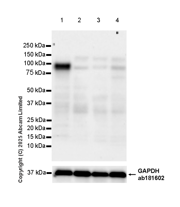 Western blot - Anti-FURIN antibody [EPR28939-503] (AB324231), expandable thumbnail