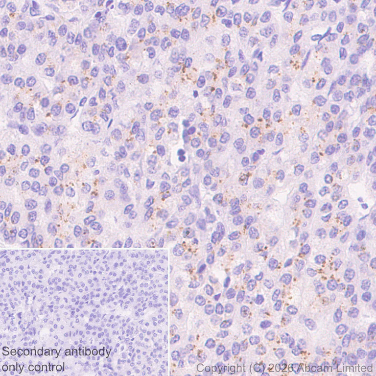 Immunohistochemistry (Formalin/PFA-fixed paraffin-embedded sections) - Anti-FURIN antibody [EPR28939-521] (AB325933)