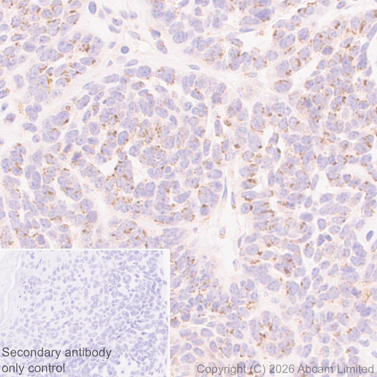 Immunohistochemistry (Formalin/PFA-fixed paraffin-embedded sections) - Anti-FURIN antibody [EPR28939-521] (AB325933)