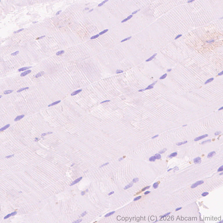 Immunohistochemistry (Formalin/PFA-fixed paraffin-embedded sections) - Anti-FURIN antibody [EPR28939-521] (AB325933)