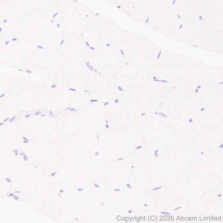 Immunohistochemistry (Formalin/PFA-fixed paraffin-embedded sections) - Anti-FURIN antibody [EPR28939-521] (AB325933)
