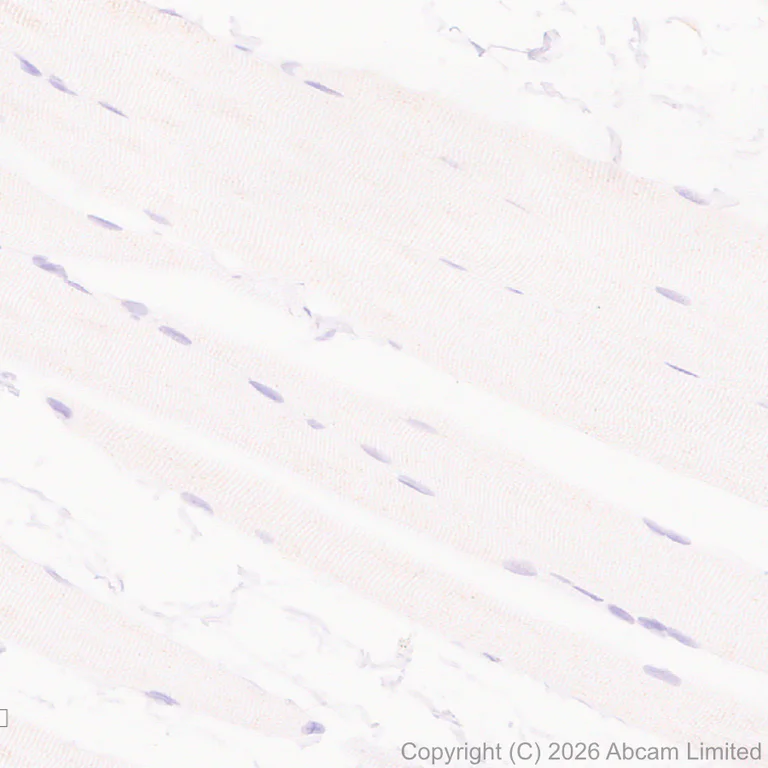 Immunohistochemistry (Formalin/PFA-fixed paraffin-embedded sections) - Anti-FURIN antibody [EPR28939-521] (AB325933)