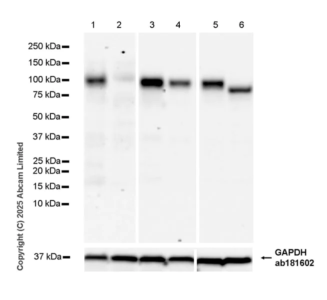 Western blot - Anti-FURIN antibody [RM2083] (AB324440)