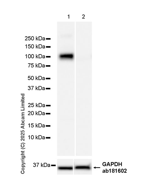 Western blot - Anti-FURIN antibody [RM2083] (AB324440), expandable thumbnail