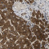 Immunohistochemistry (Formalin/PFA-fixed paraffin-embedded sections) - Anti-FUT11 antibody (AB121411), expandable thumbnail