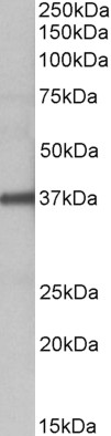 Western blot - Anti-FUT2 antibody (AB177239)