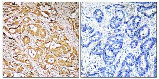 Immunohistochemistry (Formalin/PFA-fixed paraffin-embedded sections) - Anti-FUT3 antibody (AB110082)