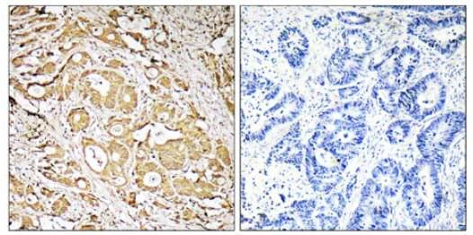 Immunohistochemistry (Formalin/PFA-fixed paraffin-embedded sections) - Anti-FUT3 antibody (AB110082)