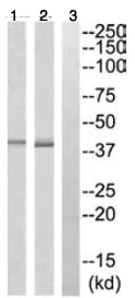 Western blot - Anti-FUT3 antibody (AB110082)