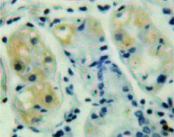 Immunohistochemistry (Formalin/PFA-fixed paraffin-embedded sections) - Anti-FUT4 antibody (AB231561)