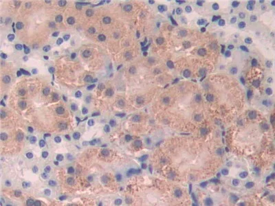 Immunohistochemistry (Formalin/PFA-fixed paraffin-embedded sections) - Anti-FUT4 antibody (AB231561)