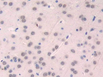 Immunohistochemistry (Formalin/PFA-fixed paraffin-embedded sections) - Anti-FUT4 antibody (AB231561)