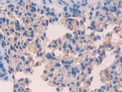 Immunohistochemistry (Formalin/PFA-fixed paraffin-embedded sections) - Anti-FUT4 antibody (AB231561)