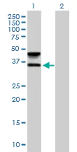 Western blot - Anti-FUT6 antibody (AB169490)