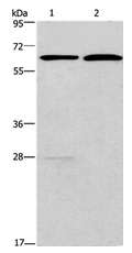 Western blot - Anti-FUT8 antibody (AB198741), expandable thumbnail