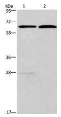 Western blot - Anti-FUT8 antibody (AB198741)