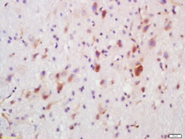 Immunohistochemistry (Formalin/PFA-fixed paraffin-embedded sections) - Anti-FUT8 antibody (AB204124)