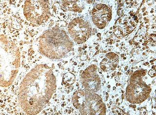 Immunohistochemistry (Formalin/PFA-fixed paraffin-embedded sections) - Anti-FUT9 antibody (AB176794)