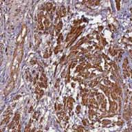 Immunohistochemistry (Formalin/PFA-fixed paraffin-embedded sections) - Anti-FUZ antibody (AB122742), expandable thumbnail