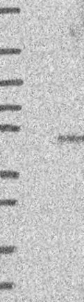 Western blot - Anti-FUZ antibody (AB122742), expandable thumbnail