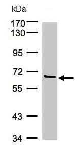 Western blot - Anti-FXI antibody (AB97346)
