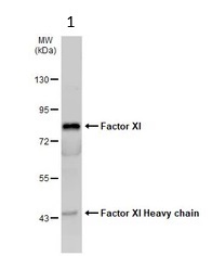 Western blot - Anti-FXI antibody (AB97346)