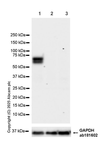 Western blot - Anti-FXI antibody [EPR29204-87] (AB323450), expandable thumbnail
